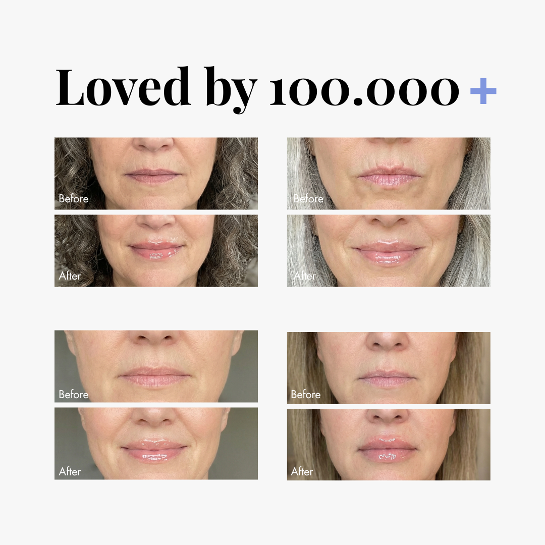 Triple Lip Plumper Bundle — lifestyle photo | Smooche