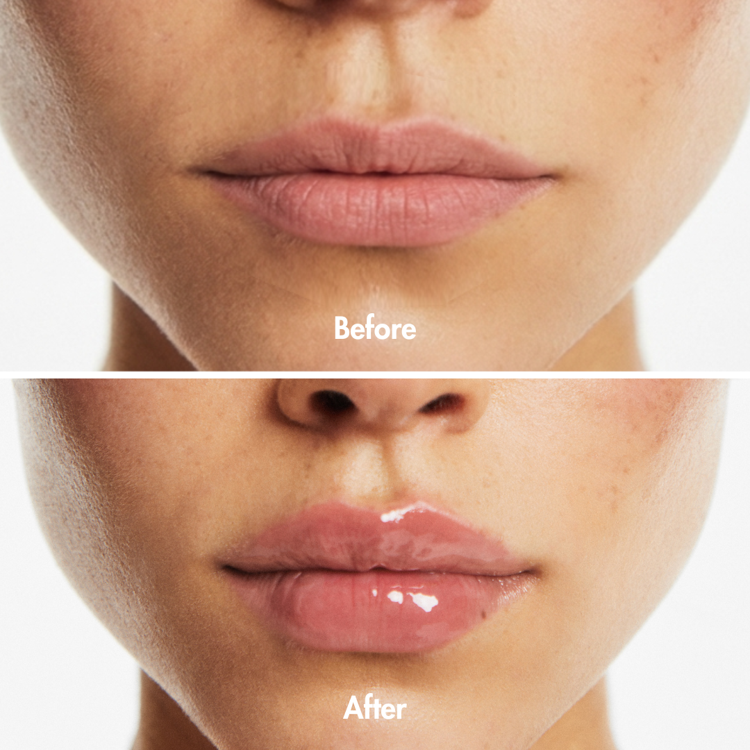 Extreme Lip Plumper — ingredients and formula | Smooche