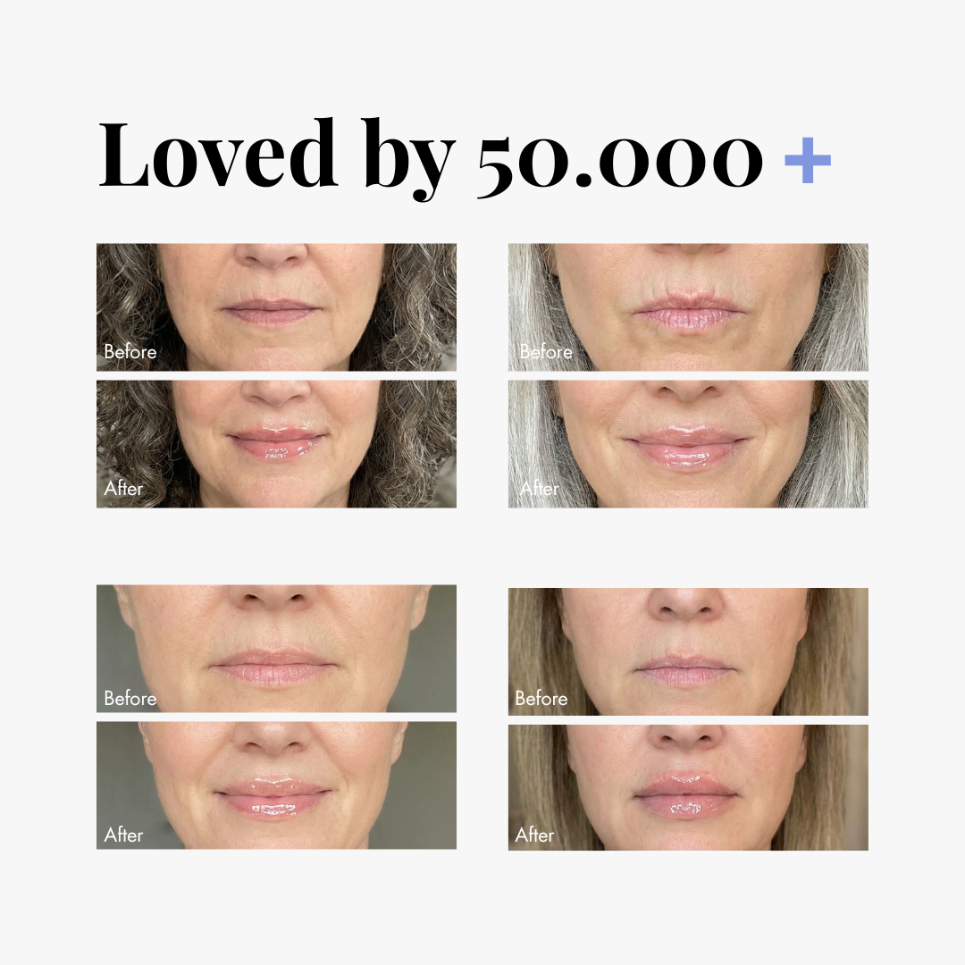 Extreme Lip Plumper — lifestyle photo | Smooche