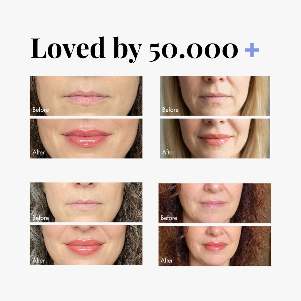 Extreme Lip Plumper — lifestyle photo | Smooche