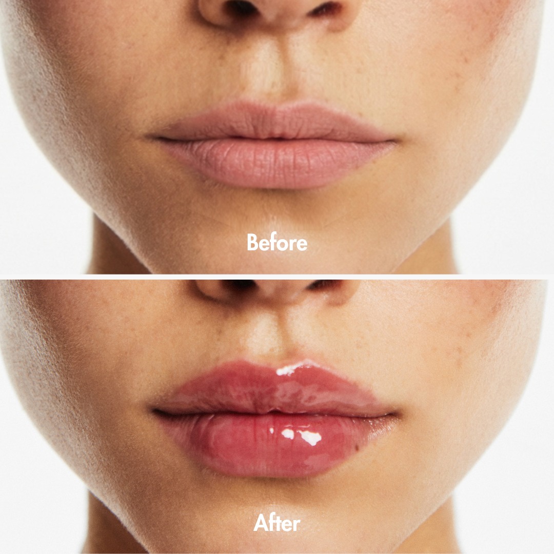 Extreme Lip Plumper — lifestyle photo | Smooche