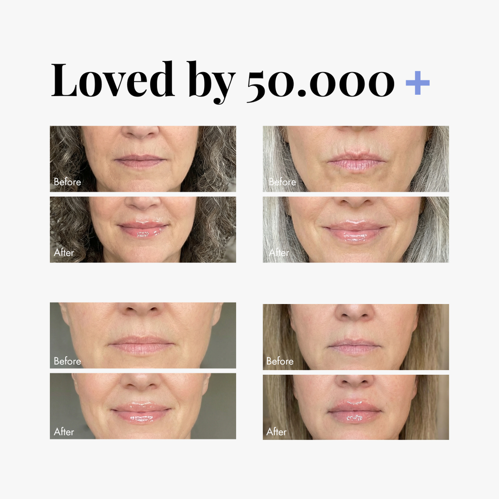 Normal Lip Plumper — lifestyle photo | Smooche